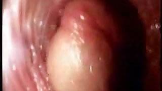 Video from the inside of a vagina... very interesting hot road sex tumblr video